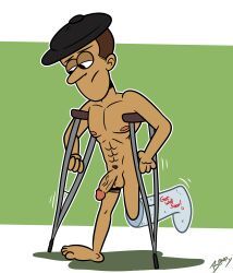 davey_divots, the_loud_house, onlyboney, balls, broken_leg
